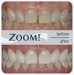 Afton Family Dental