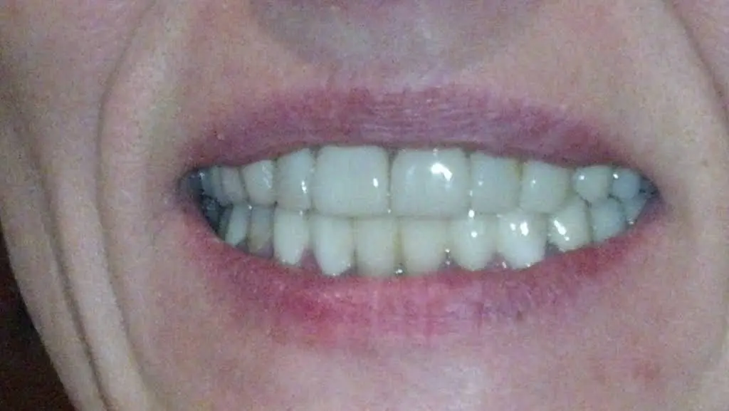 DentaLux LLC