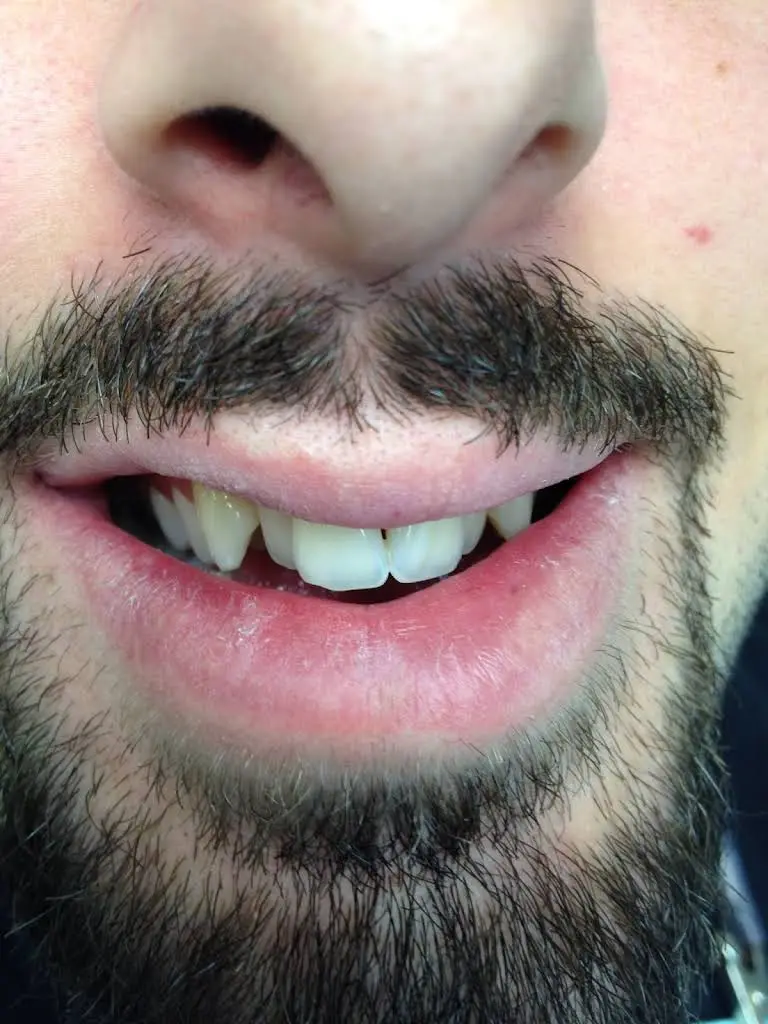 DentaLux LLC