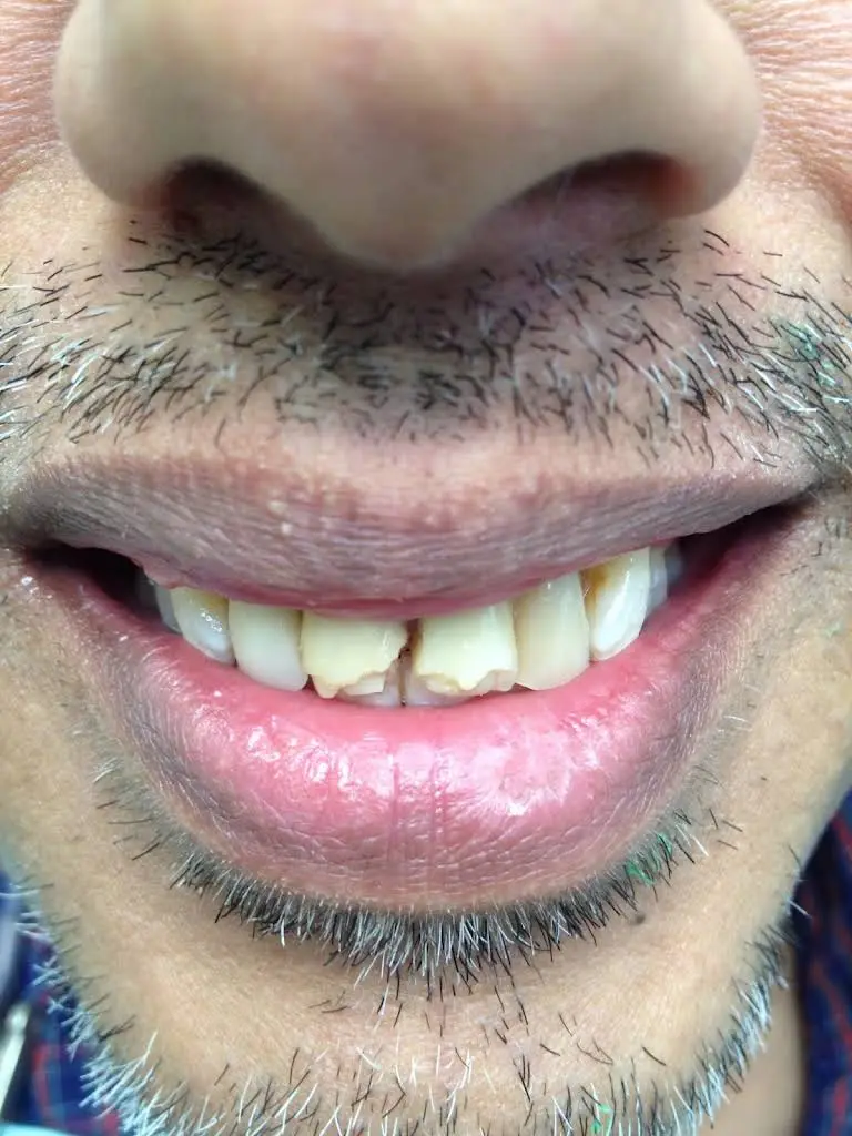 DentaLux LLC