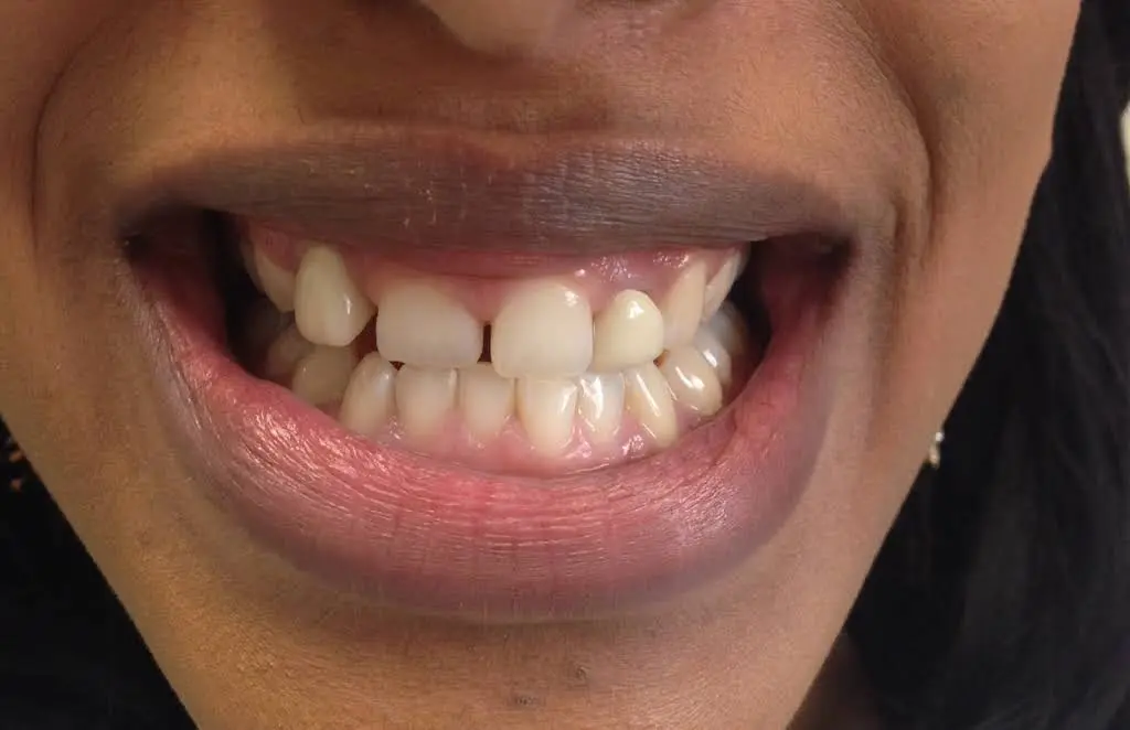 DentaLux LLC