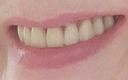SmileDefenders