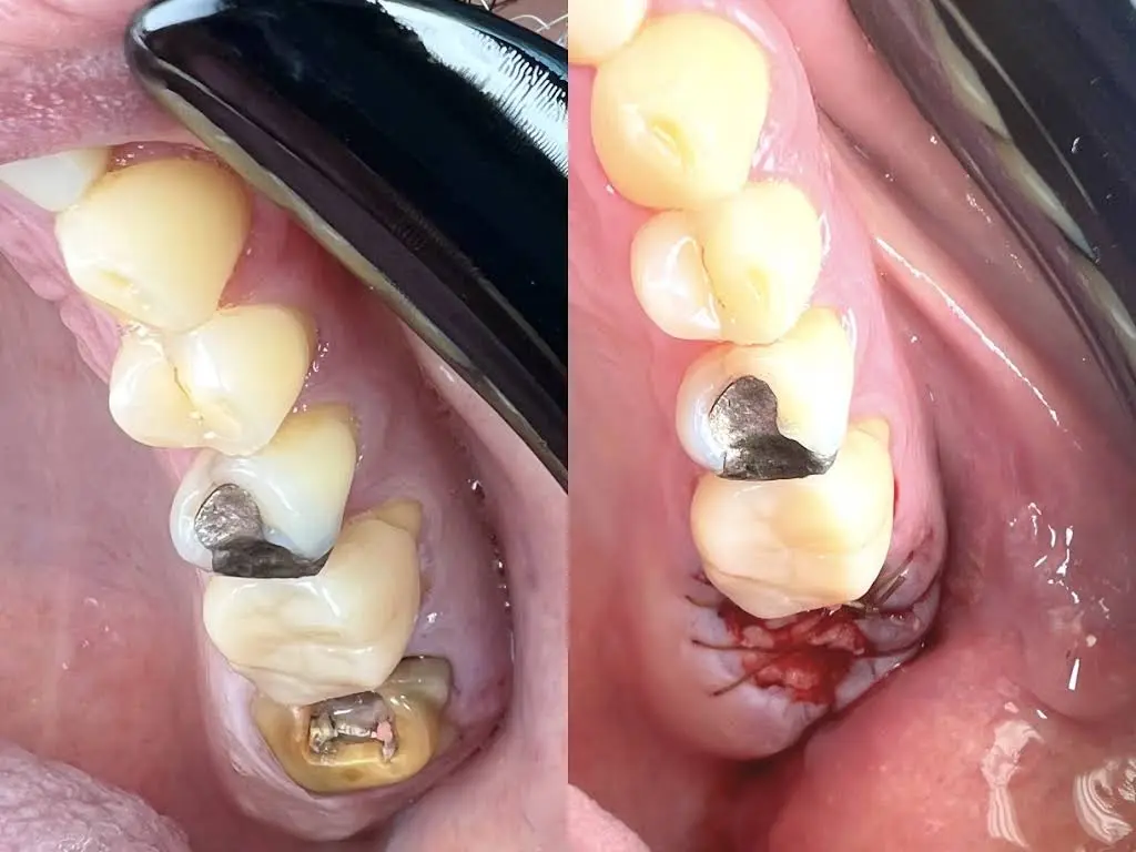Prime Dentistry of Northeast Philadelphia