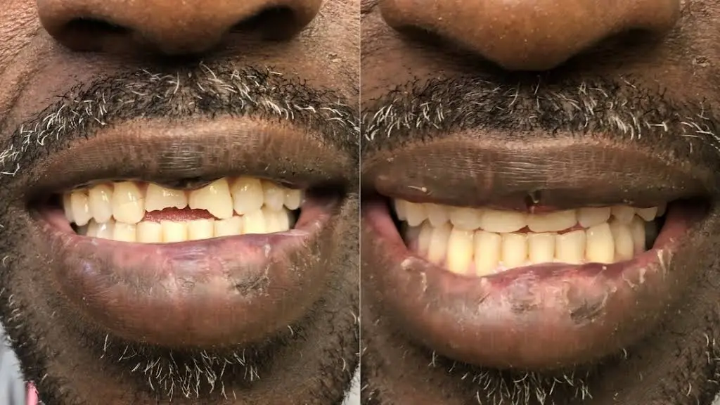 Prime Dentistry of Northeast Philadelphia