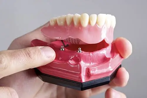 Optimum Oral Surgery & Dental Implants