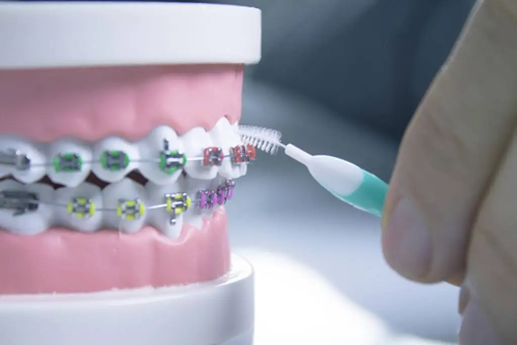 Orthodontists Associates of Western New York