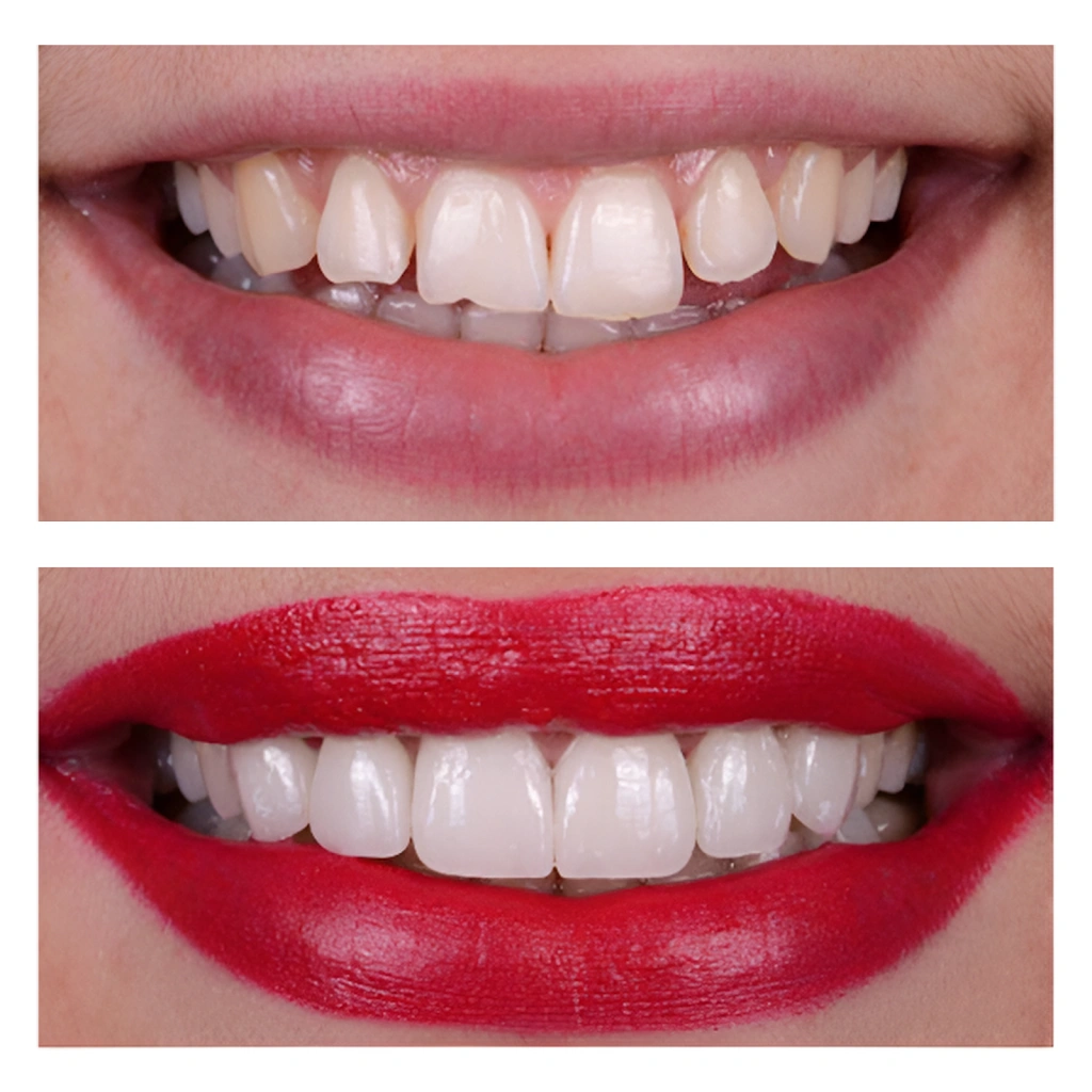 Azar Dental
