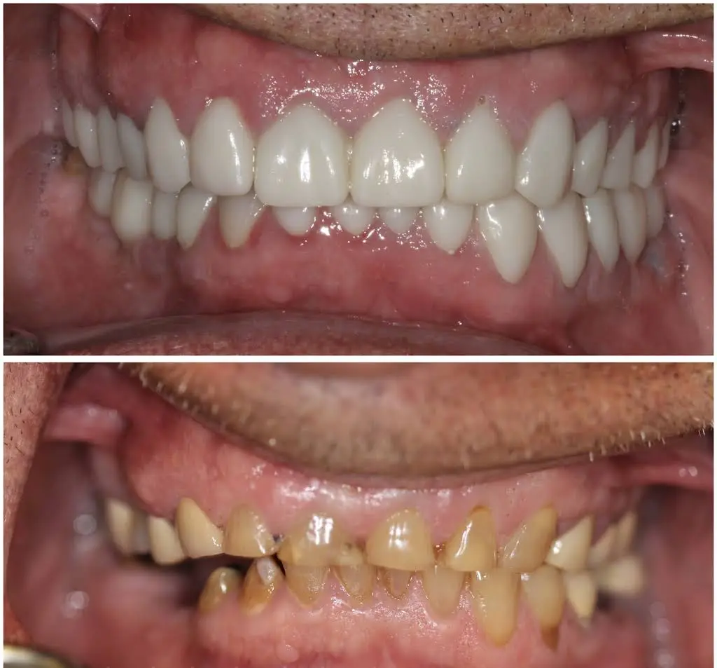 Azar Dental