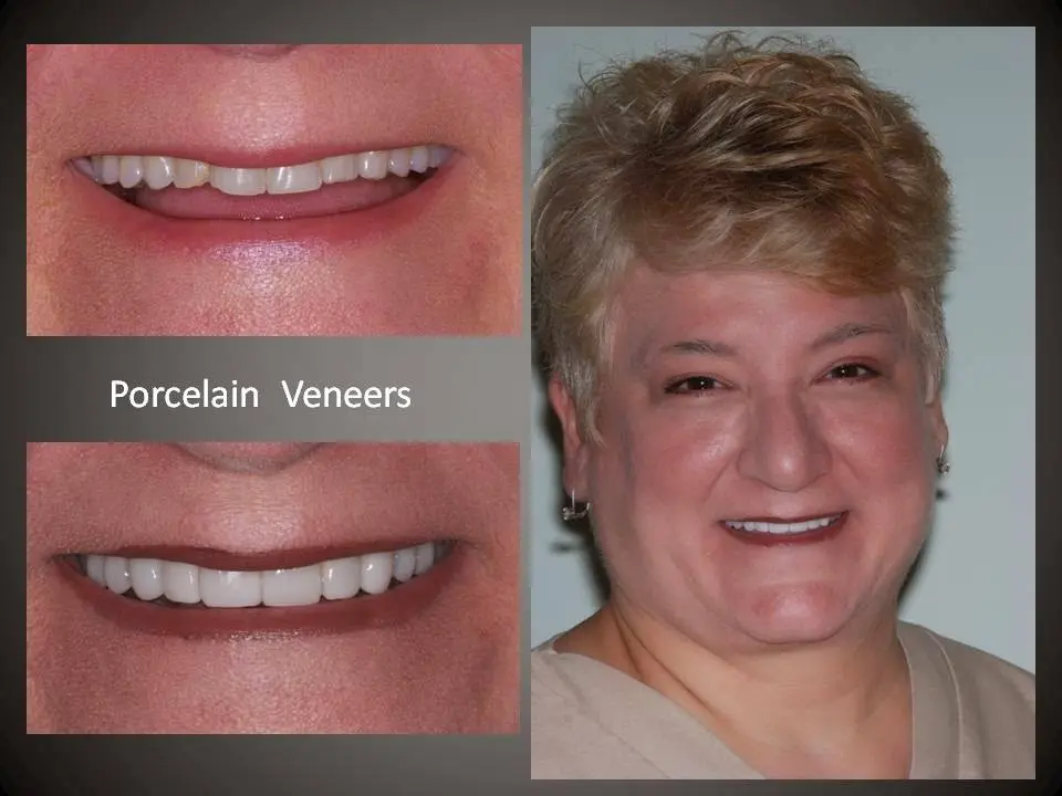 Dentistry in Philadelphia