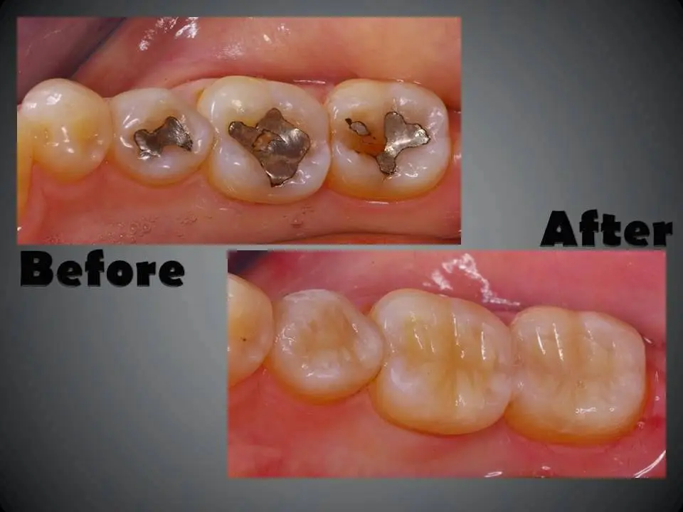 Dentistry in Philadelphia