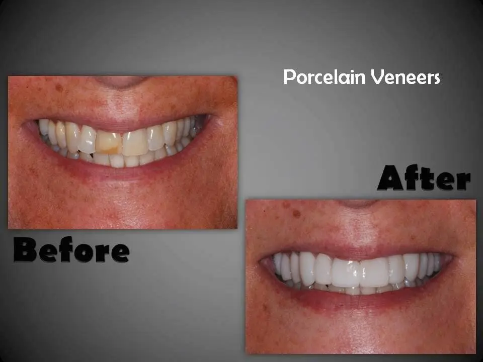 Dentistry in Philadelphia
