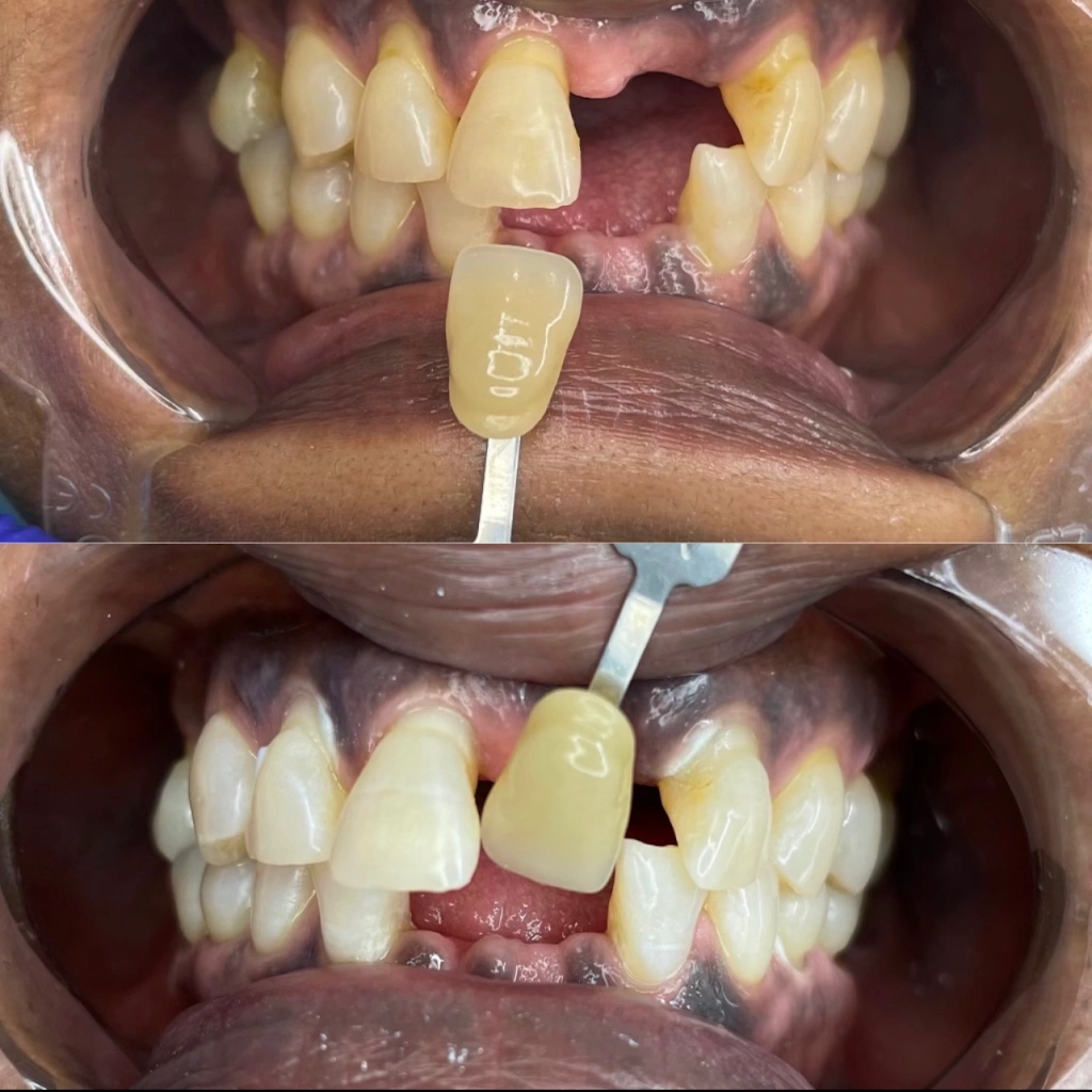 Dentist Near Me PLLC