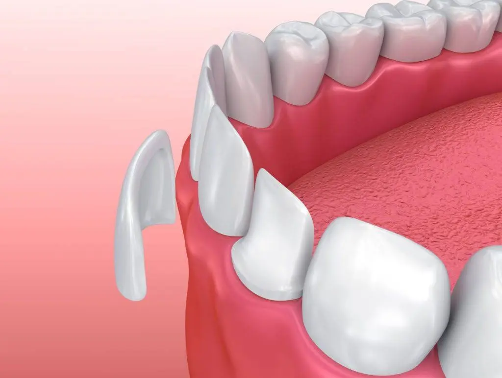 Castor Dental Care
