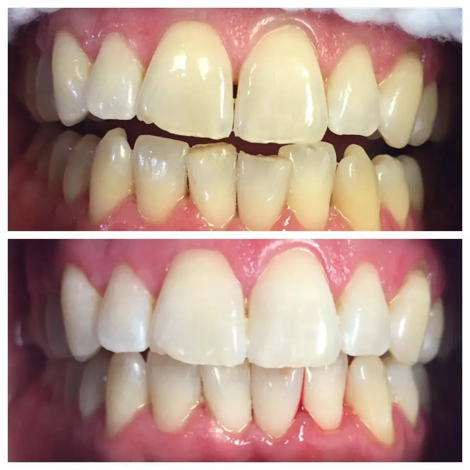 Dental Associates At Pitman
