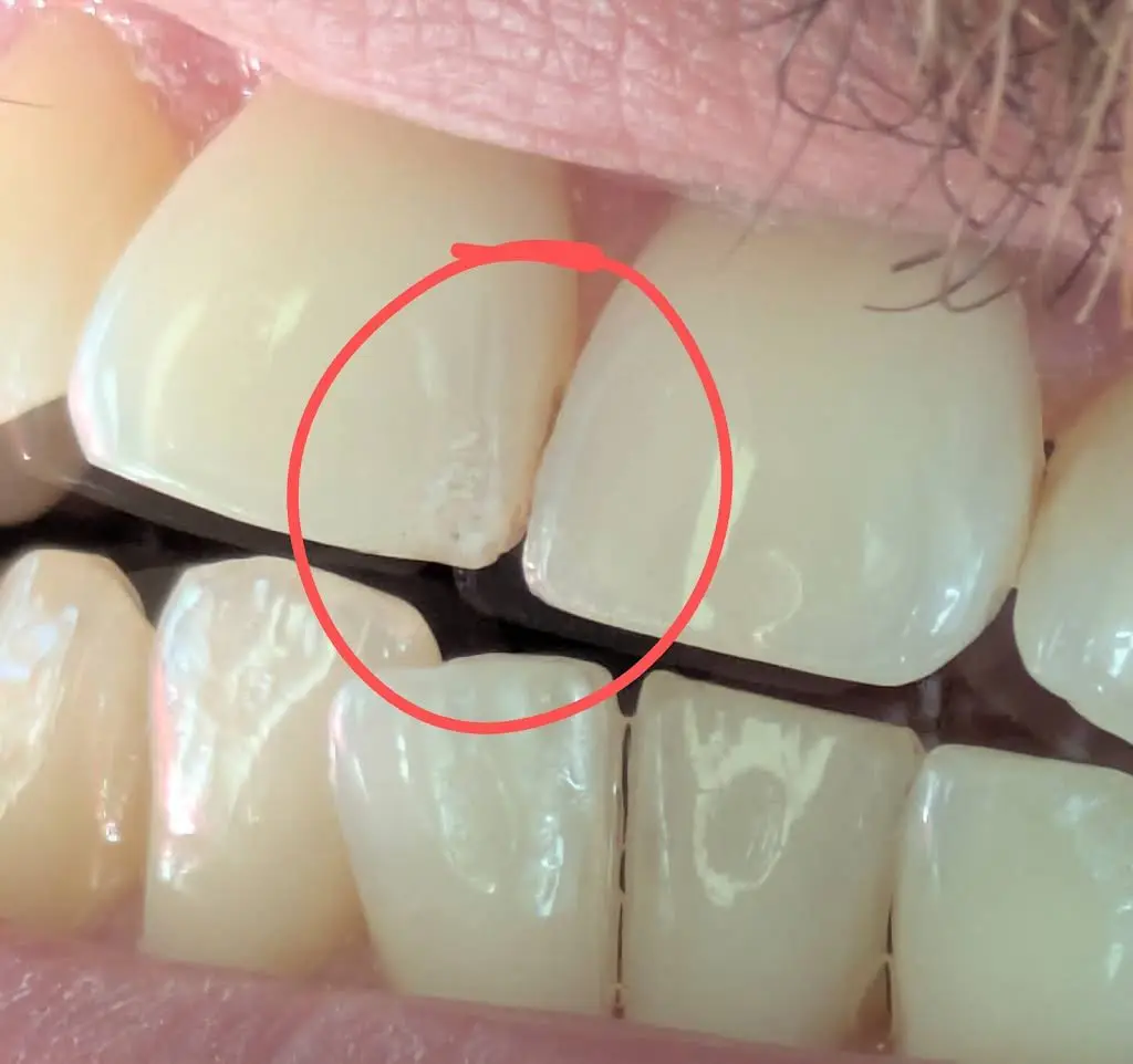 Warren Dental Design
