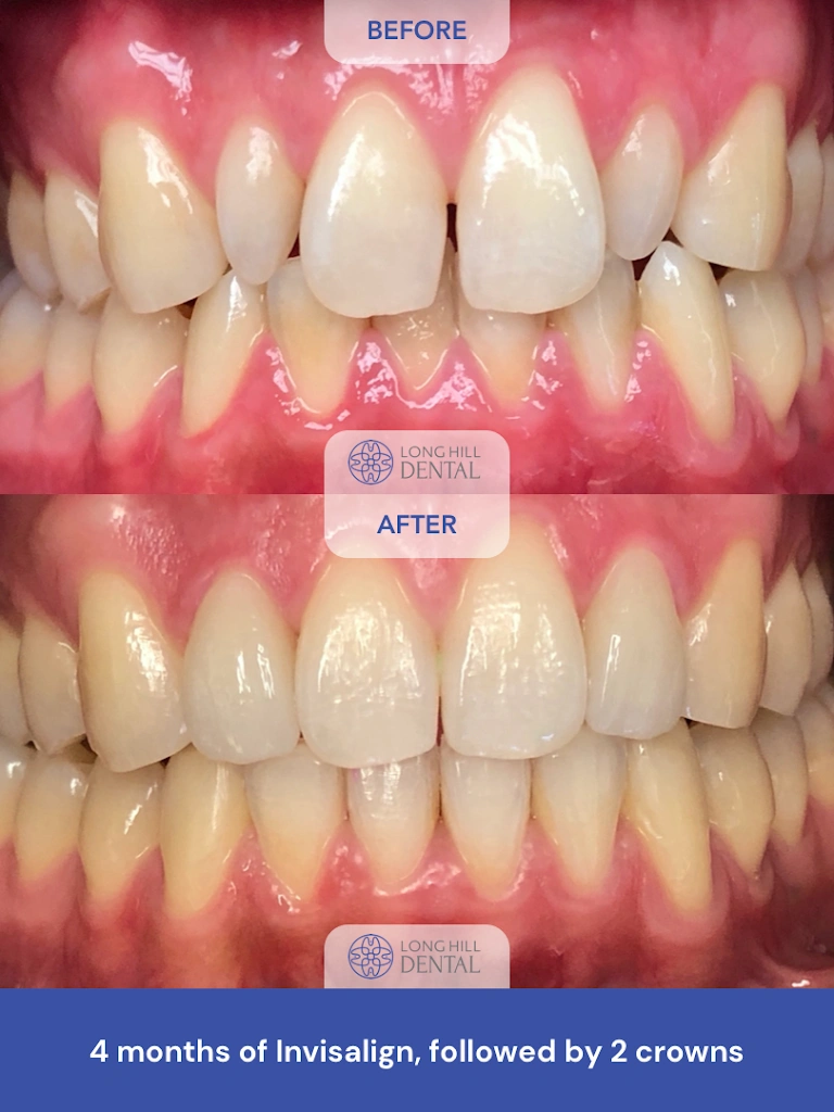 Long Hill Dental