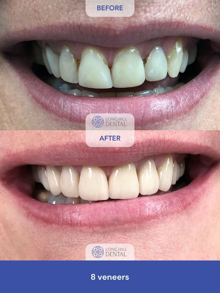 Long Hill Dental