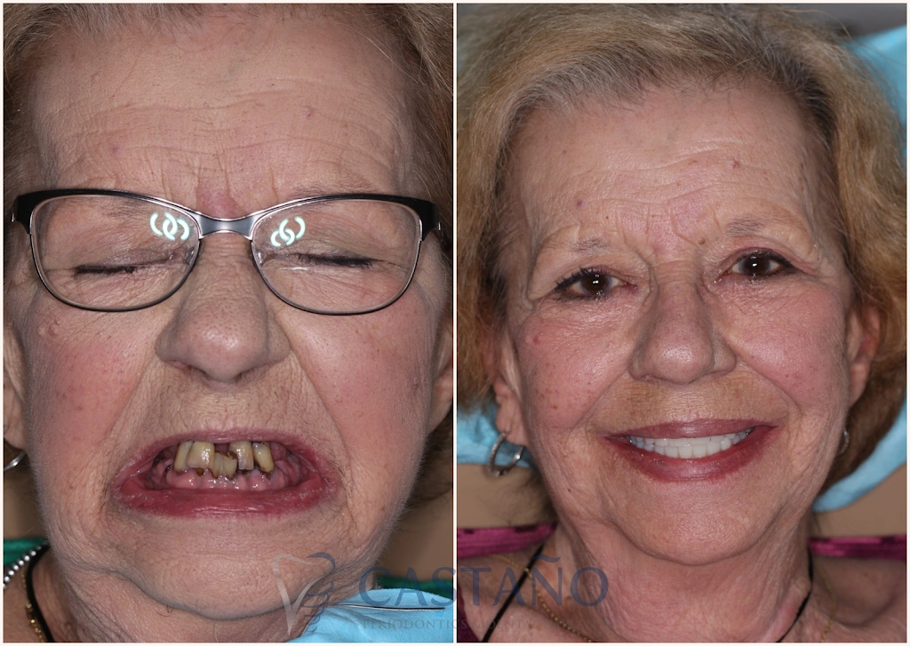 Castano Periodontics and Dental Implants