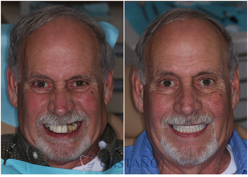 Castano Periodontics and Dental Implants