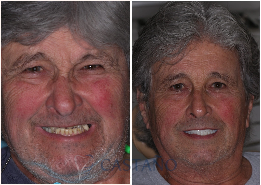Castano Periodontics and Dental Implants