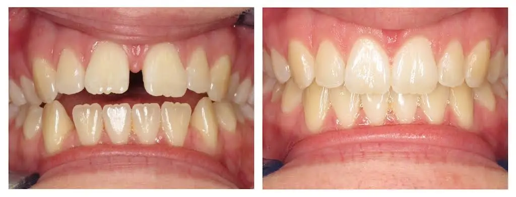 Whippany Dental Design