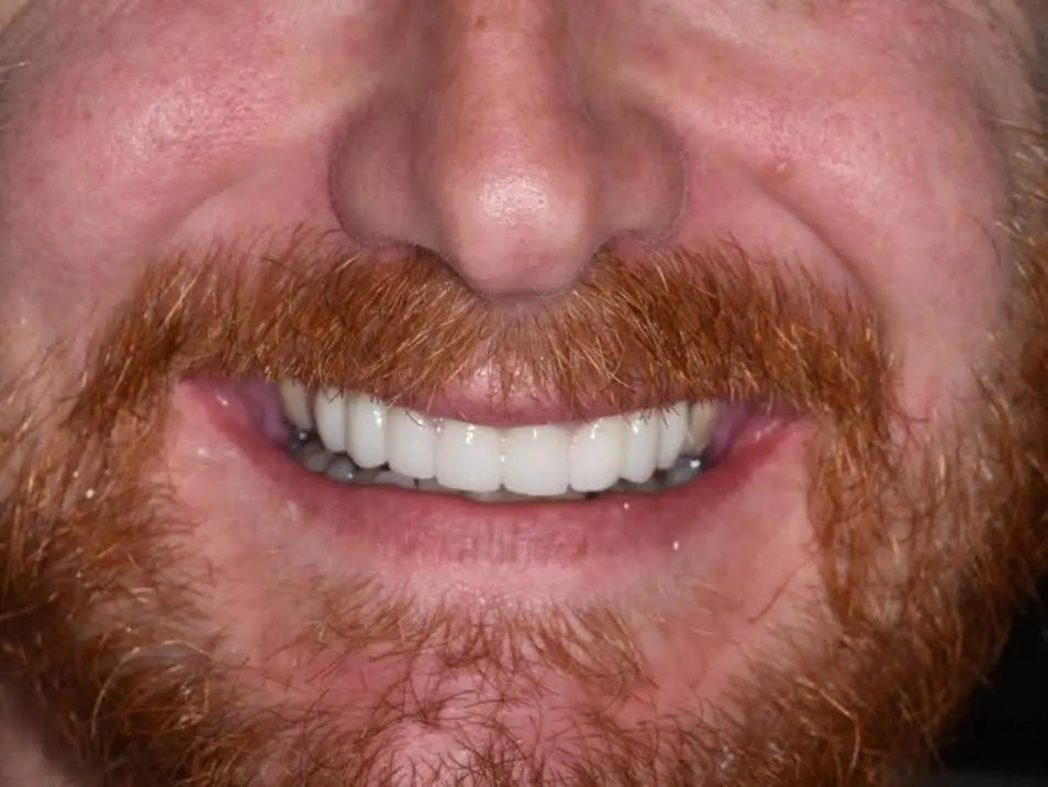 Dr. Ralff Center for Cosmetic & Implant dentistry