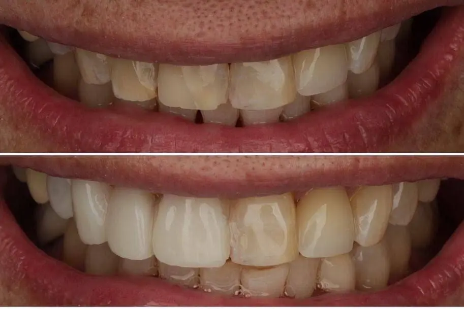 Lowcountry Dental Arts