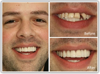 Dental Arts Group - Northeast Philadelphia