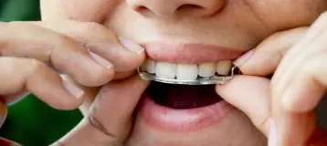 Aces Braces