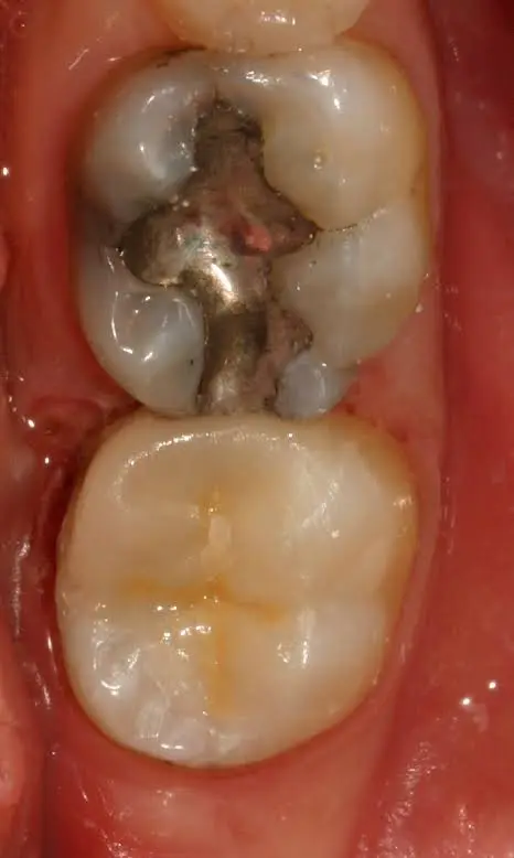 South Jersey Center For Advanced Dentistry