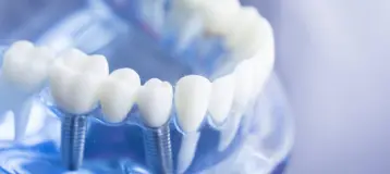 Dental Beauty