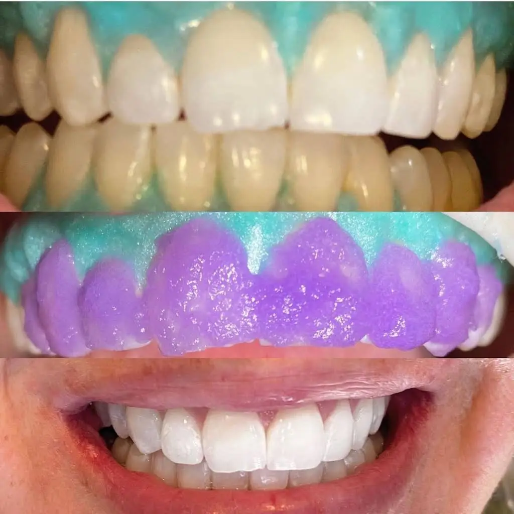 Skylaserdental