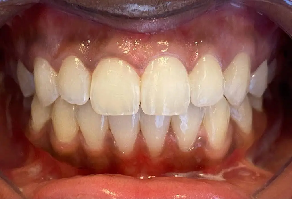 Skylaserdental