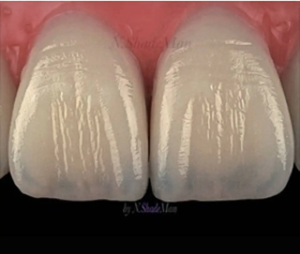 Skylaserdental