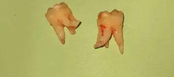 Everest Dental LLC