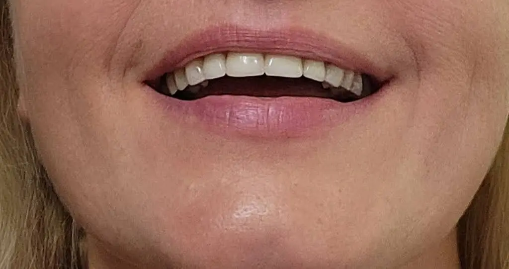 Everest Dental LLC