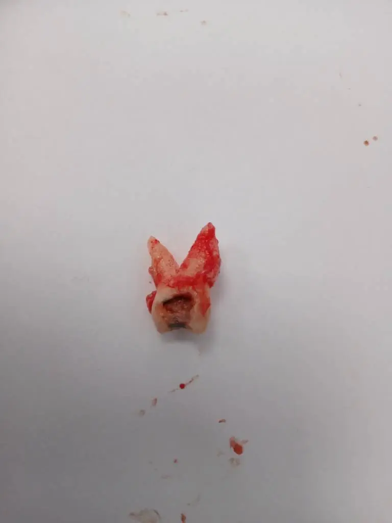Dental Made Easy