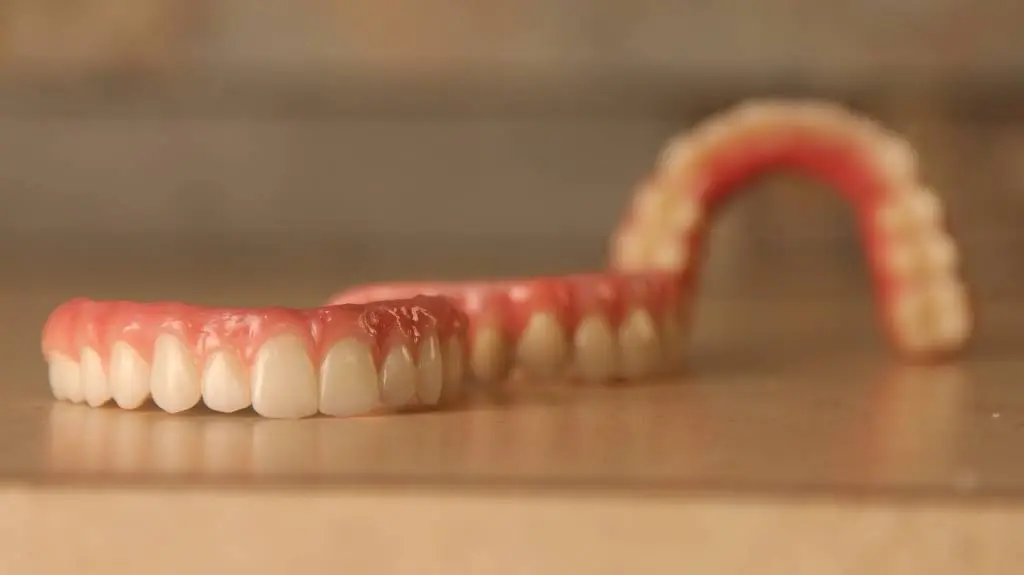 Buffalo Dental Implant