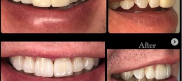 All Dental Arts Warren