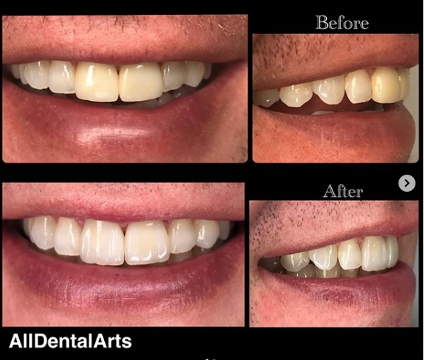 All Dental Arts Warren - Professional dental clinic exterior with modern facilities