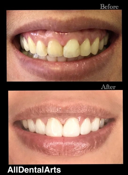All Dental Arts Warren