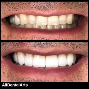 All Dental Arts Warren