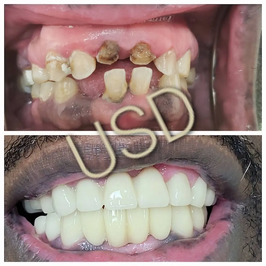 Urban Smiles Dental P.A.