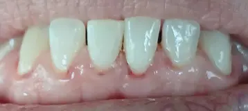 Bright Smiles Dental