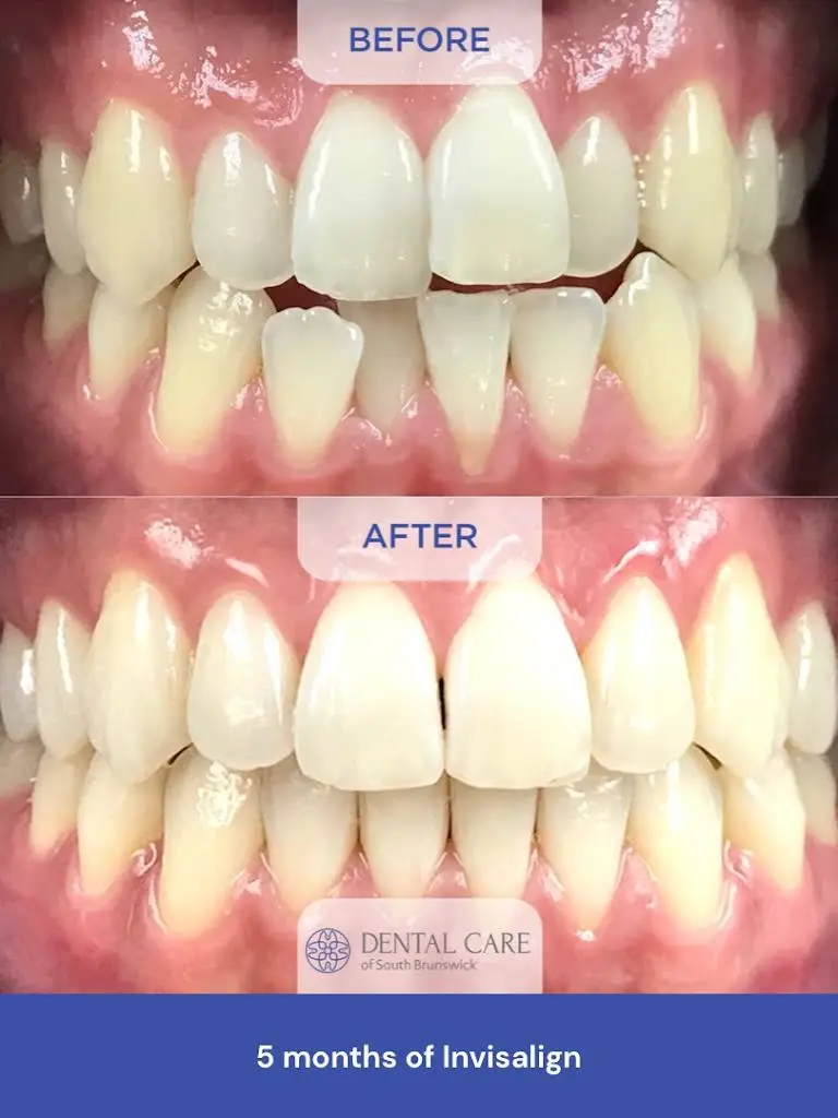 Dental Care of South Brunswick