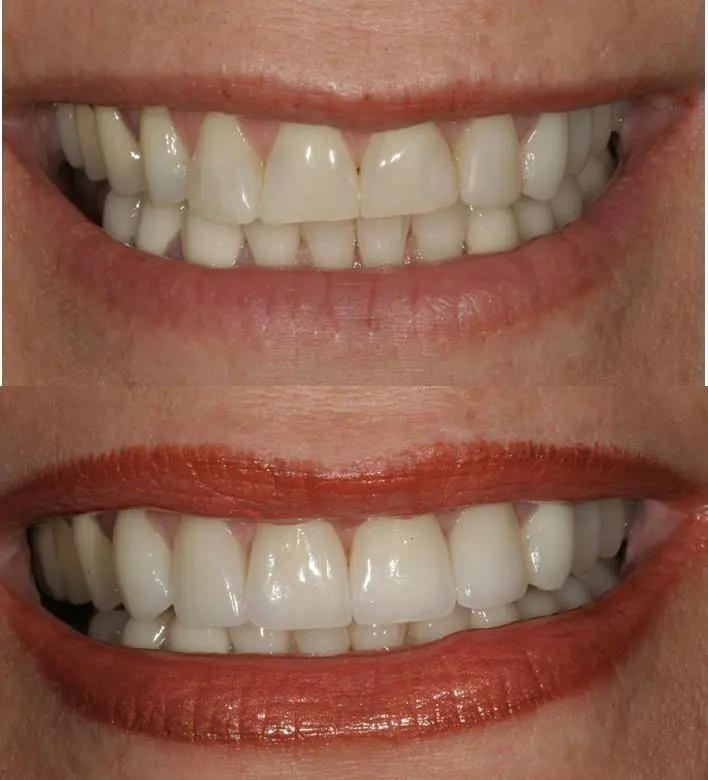 Opus Dental Esthetics: Derek Conover, DMD
