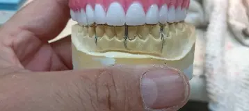 Affordable Dentures & Implants
