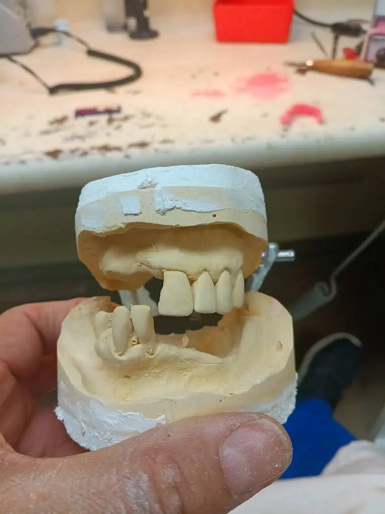 Affordable Dentures & Implants