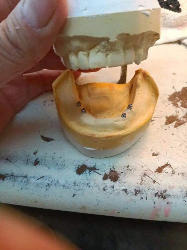 Affordable Dentures & Implants