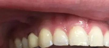 Beyond Dentistry Laser Center